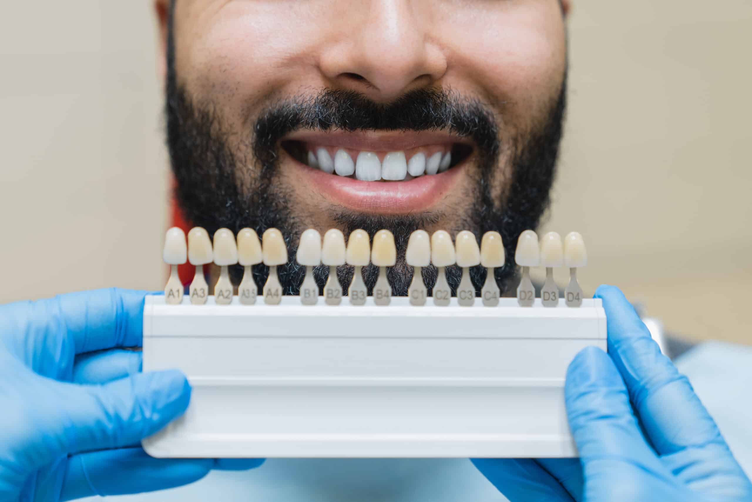 Featured image for “10 Life-Changing Cosmetic Dentistry Procedures That Will Transform Your Smile”