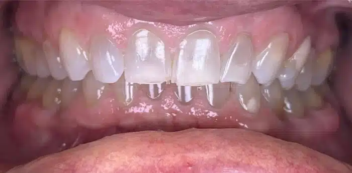Cosmetic dentistry smile – before treatment