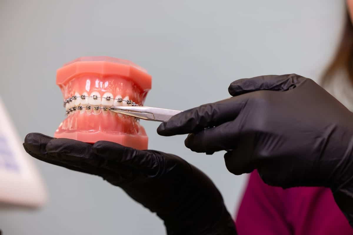 Featured image for “Why Delaying Orthodontics Could Cost You More Later”